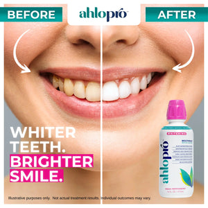 WHITENING MOUTHWASH FOR SENSITIVE MOUTHS