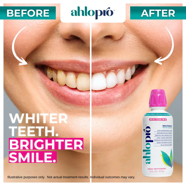 WHITENING MOUTHWASH FOR SENSITIVE MOUTHS