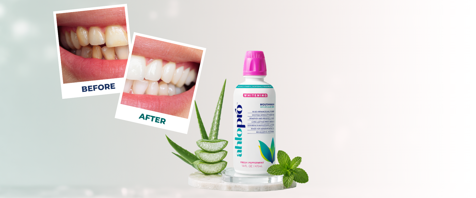 Bottle of aloe vera with 'Ahlo Pro' branding, showing 'Before' and 'After' dental care results on a white background.
