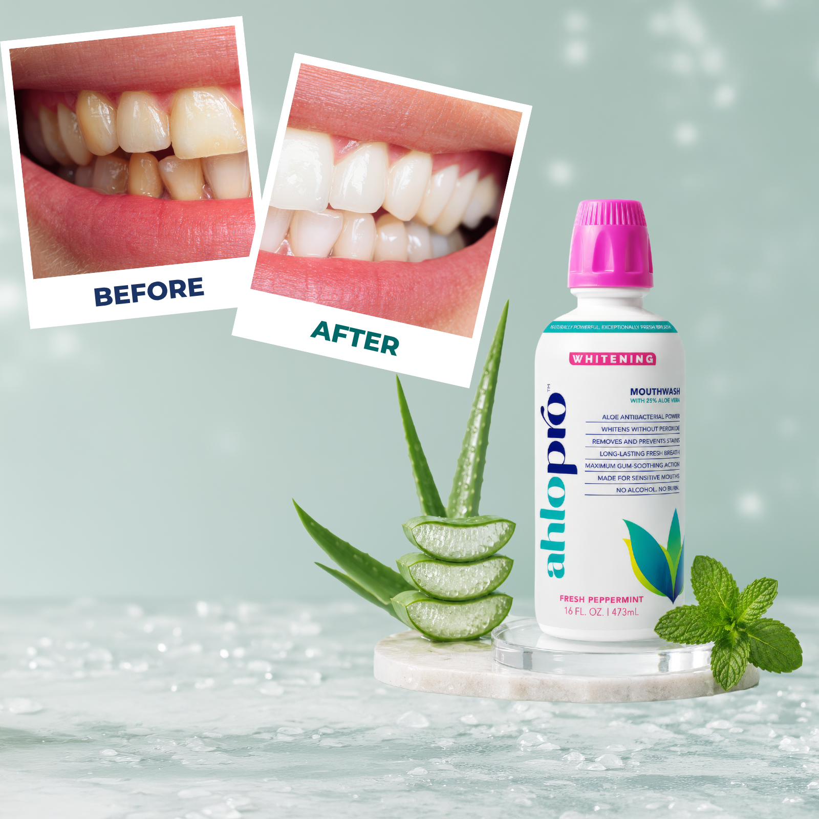 Mouthwash bottle with 'Before' and 'After' dental images and aloe vera plant on a light background